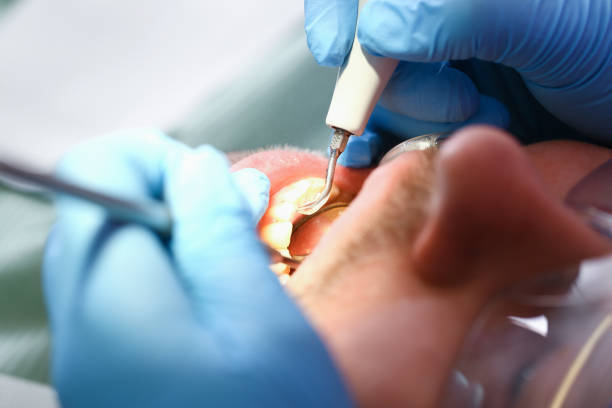 Best Emergency Broken Tooth Repair in Verona Walk, FL